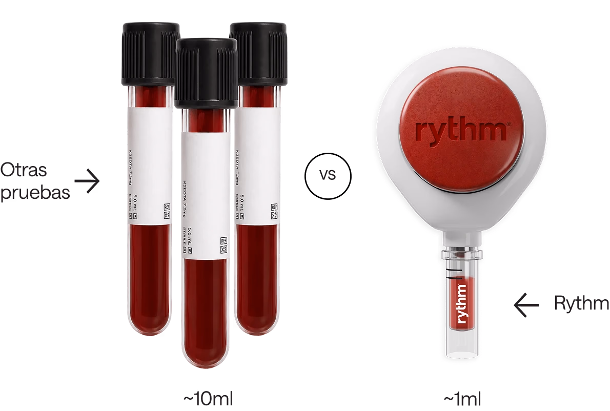 Comparación de dos muestras de sangre: un tubo de ensayo lleno etiquetado como "Otras pruebas" que contiene aproximadamente 10 ml de sangre, frente a un tubo más pequeño etiquetado como "Rythm" que contiene aproximadamente 1 ml de sangre.