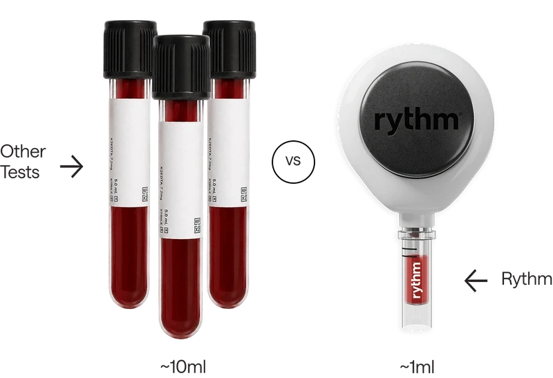 Comparison of two blood samples: a full test tube labeled “Other Tests” containing ~10 ml of blood, versus a smaller tube labeled “Rythm” containing ~1 ml of blood.