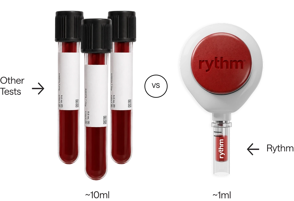 Comparison of two blood samples: a full test tube labeled “Other Tests” containing ~10 ml of blood, versus a smaller tube labeled “Rythm” containing ~1 ml of blood.